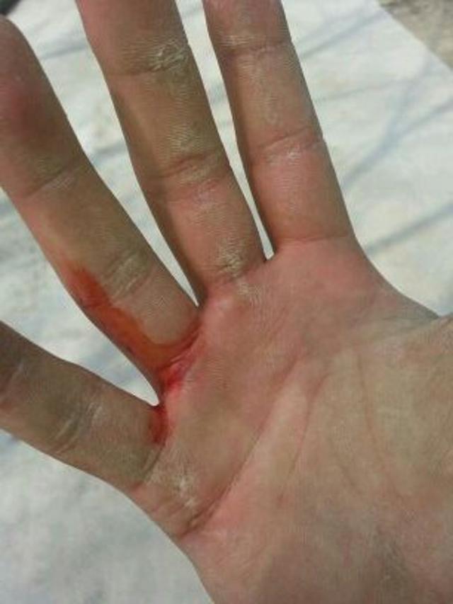 在脚上发现我的手