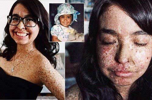 真实存在的16个骇人听闻疾病