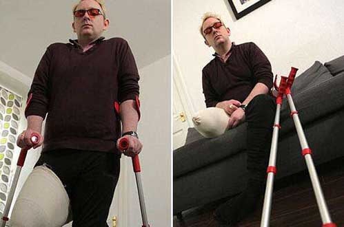 真实存在的16个骇人听闻疾病-身体完整认同障碍