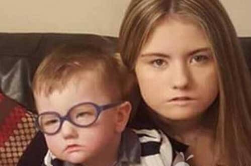 真实存在的16个骇人听闻疾病-牟比士综合症