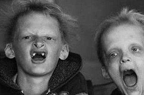 真实存在的16个骇人听闻疾病-卟啉症