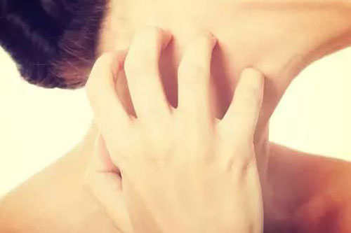 你的婚姻止痒秘籍是什么