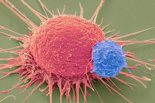 你会患上什么样的爱情绝症