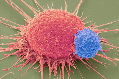 你的爱情绝症是什么