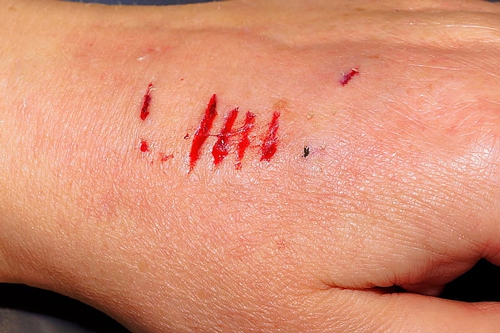 梦见狗抓伤了手